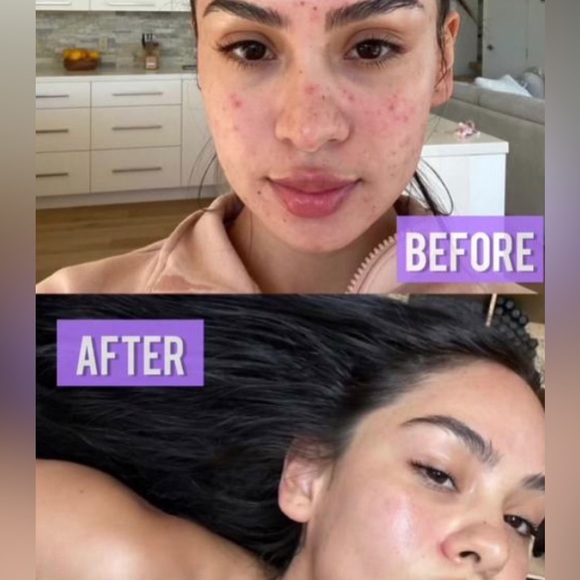 NEW! TimeWise® Microdermabrasion Plus Set - Picture 2 of 3